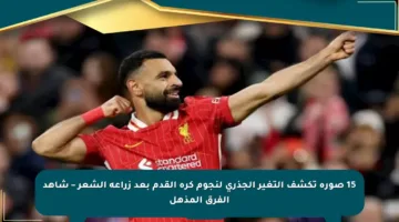 15 صورة تكشف التغير الجذري لنجوم كرة القدم بعد زراعة الشعر – شاهد الفرق المذهل